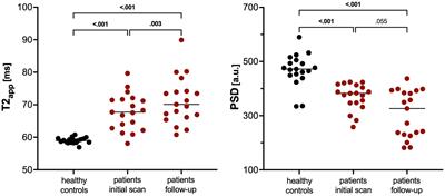 Evolution of peripheral nerve changes in early multiple sclerosis—a longitudinal MR neurography study